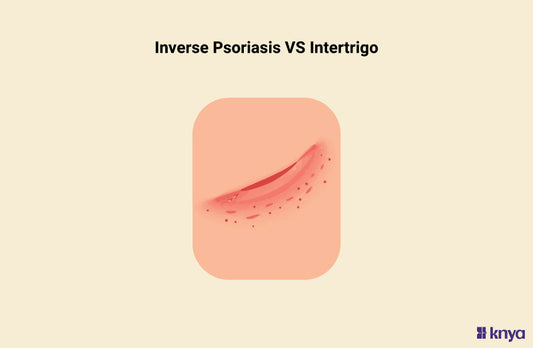 Inverse Psoriasis vs Intertrigo