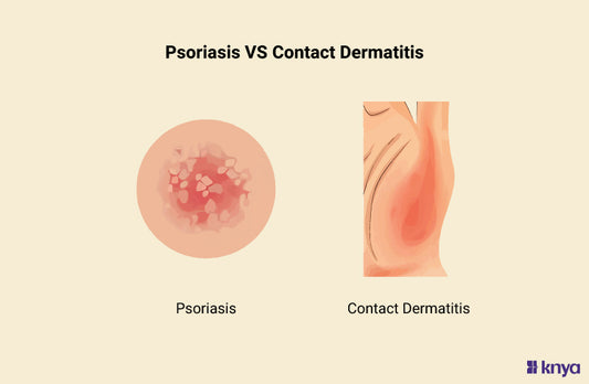 Psoriasis vs Contact Dermatitis