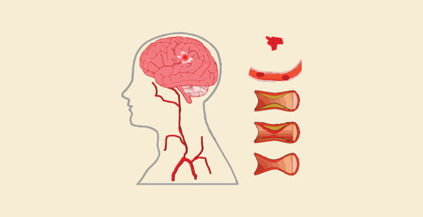 blog banner