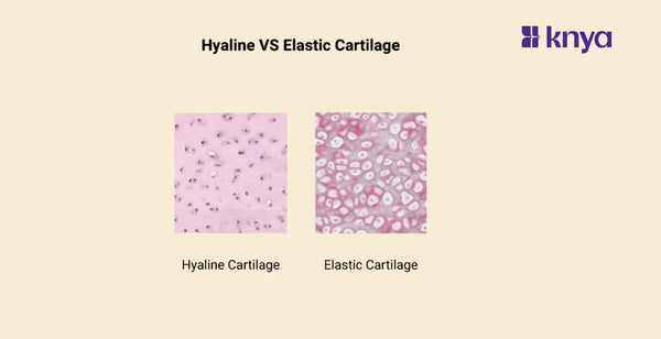 blog banner