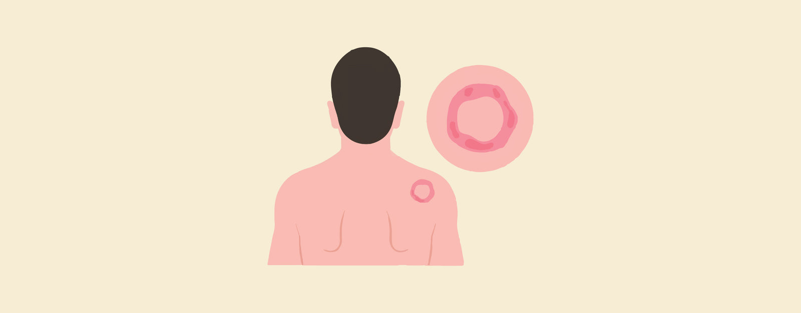 blog banner