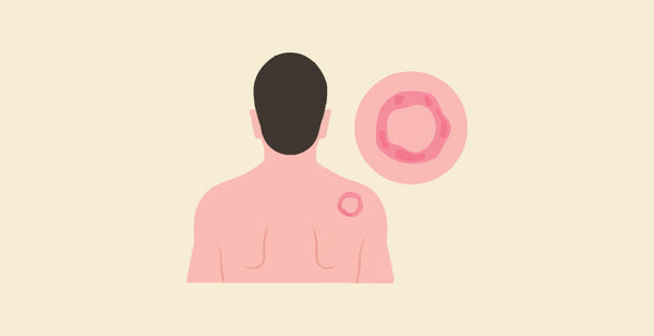 blog banner