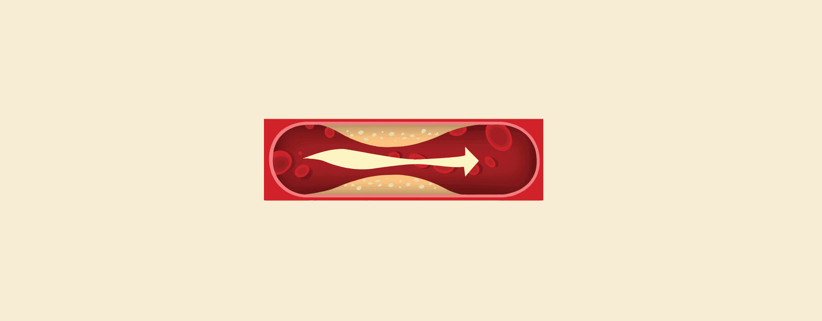 blog banner