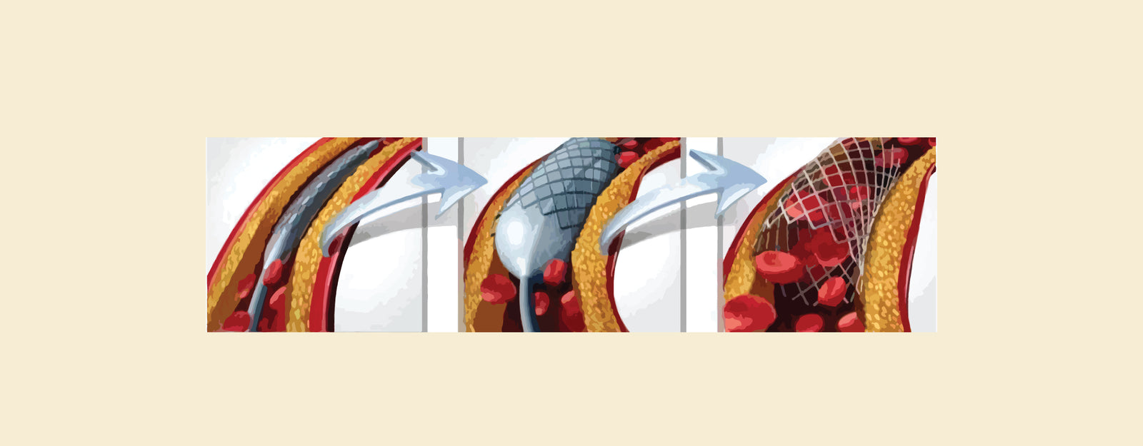 blog banner