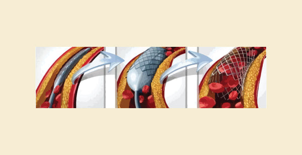 blog banner