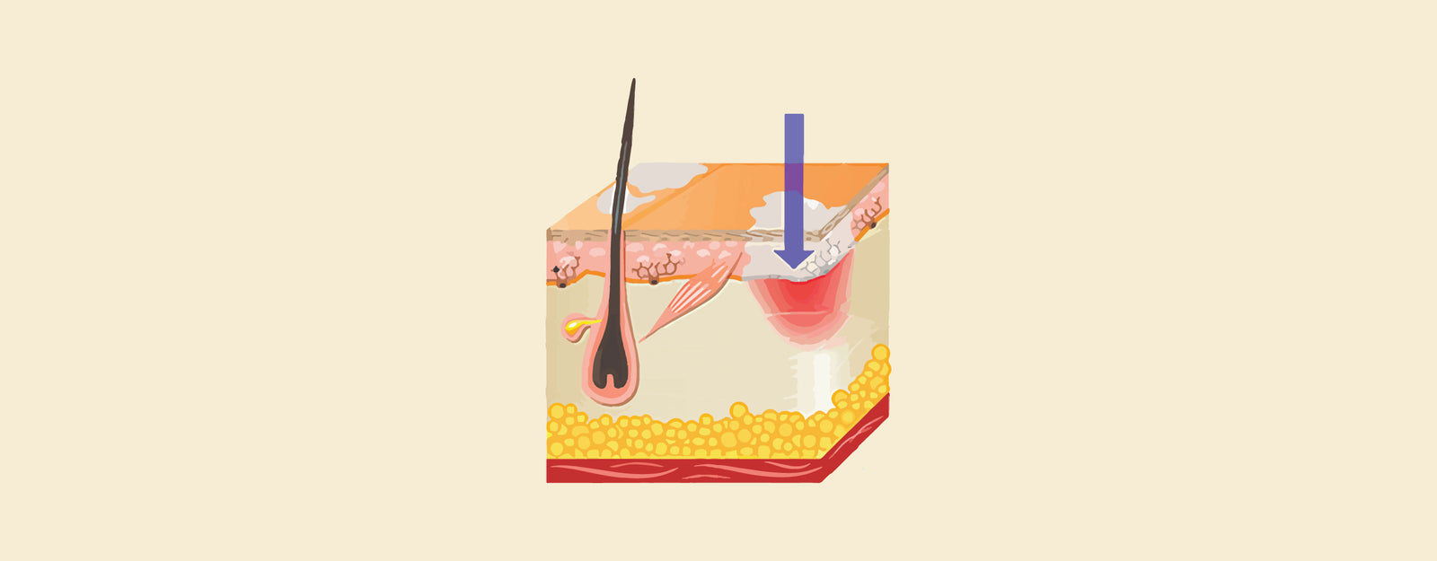 blog banner