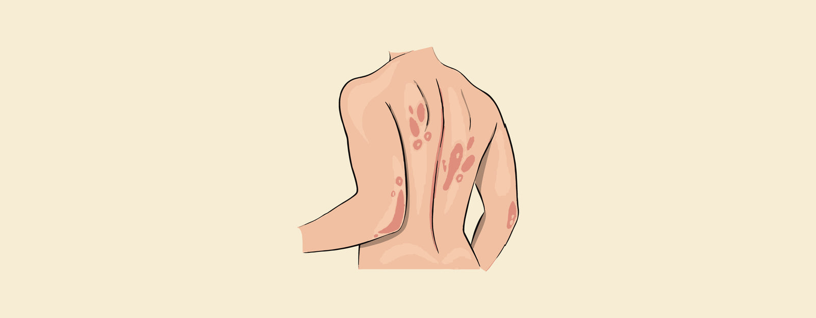 blog banner
