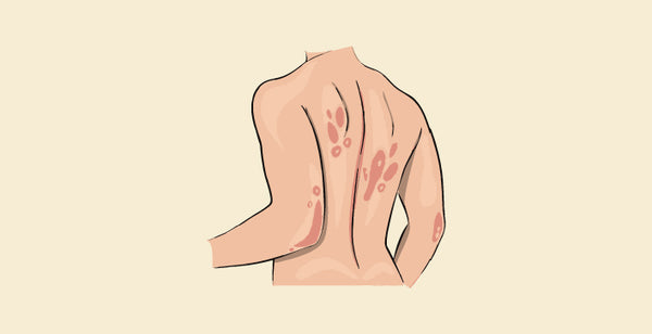 blog banner
