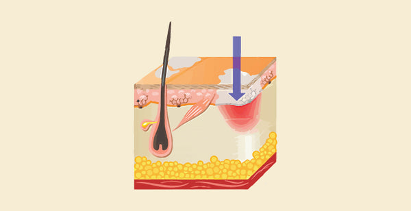 blog banner