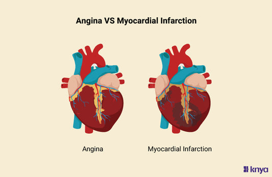 Difference Between Angina and Myocardial Infarction