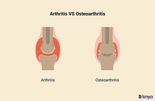 Difference Between Arthritis and Osteoarthritis