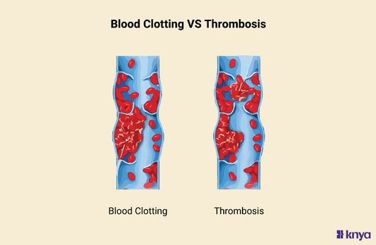 Blood Clotting vs Thrombosis: Know the Differences