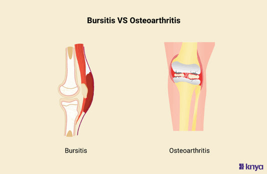 Bursitis Vs Osteoarthritis