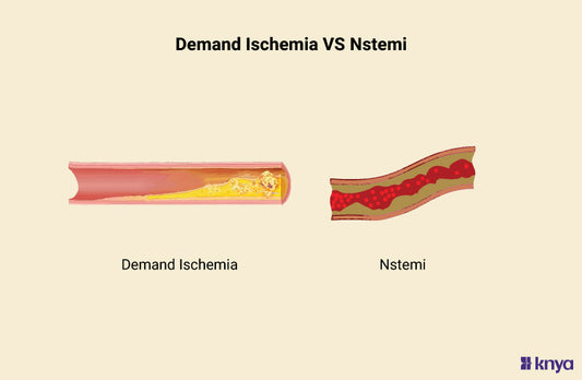 Demand Ischemia Vs NSTEMI