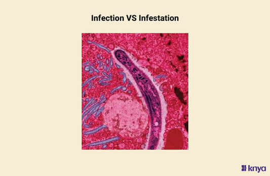 Difference Between Infection And Infestation