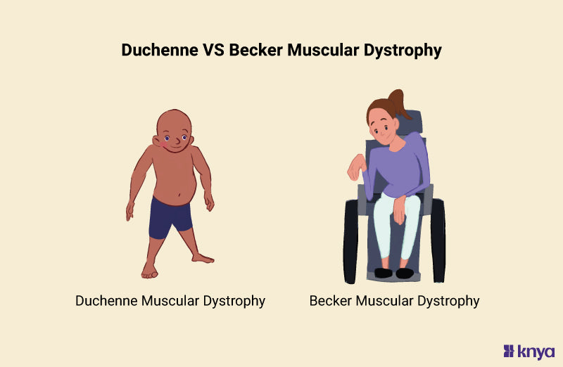 Duchenne Vs Becker Muscular Dystrophy | Key Differences Explained – Knya