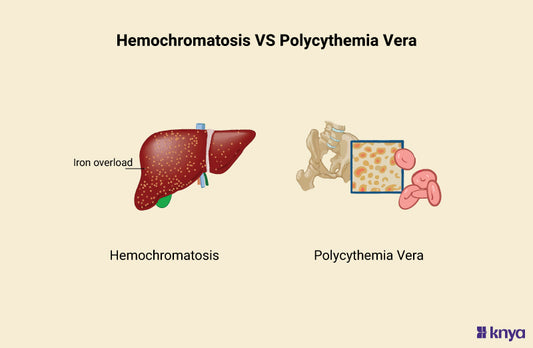 Hemochromatosis Vs Polycythemia Vera