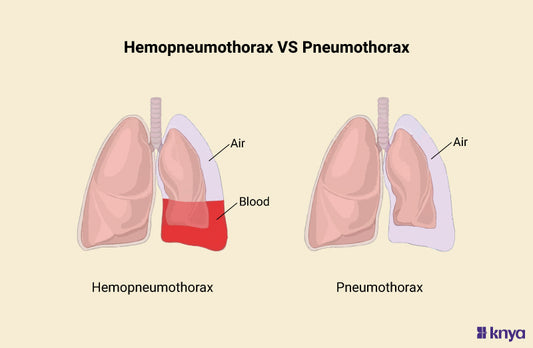 Hemopneumothorax vs Pneumothorax