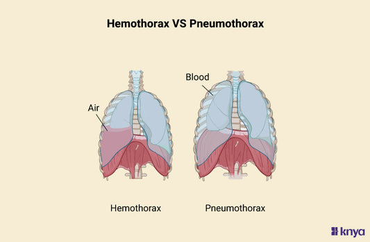 Hemothorax Vs Pneumothorax