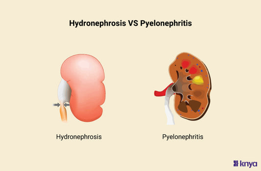 Hydronephrosis Vs Pyelonephritis
