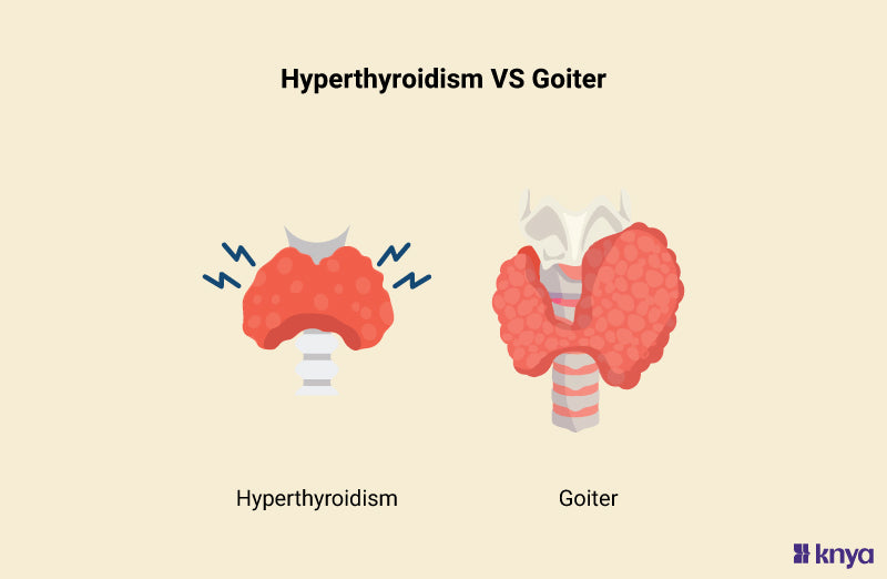 Difference Between Hyperthyroidism and Goiter | Explained! – Knya