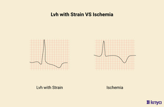 LVH with Strain vs Ischemia