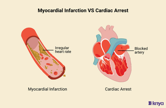Difference Between Myocardial Infarction and Cardiac Arrest