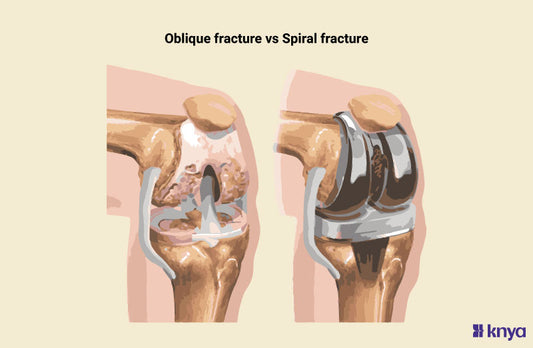 Amputation vs Limb Salvage