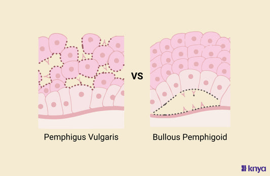 Pemphigus Vulgaris Vs Bullous Pemphigoid