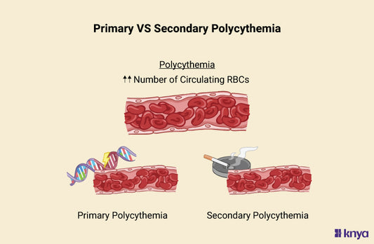 Difference Between Primary and Secondary Polycythemia