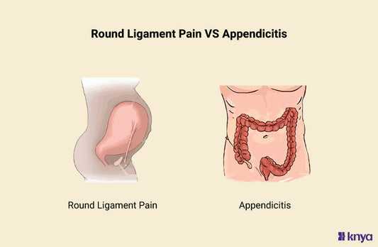 Round Ligament Pain Vs Appendicitis