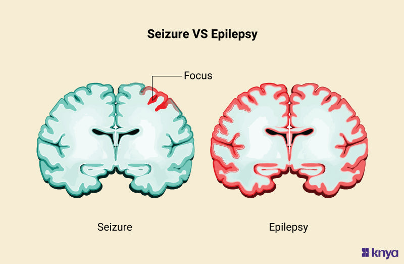 Difference Between Seizure and Epilepsy