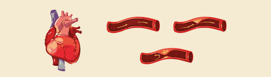 Difference Between Stenosis and Thrombosis