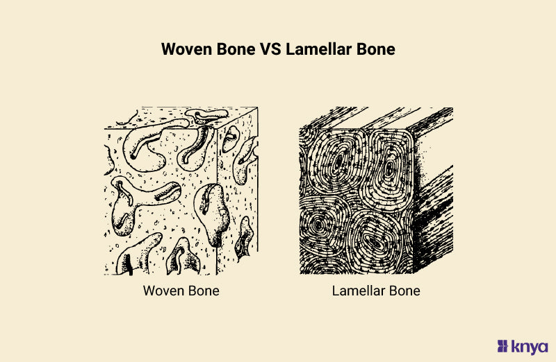 Woven Bone Vs. Lamellar Bone | Key Differences Explained – Knya