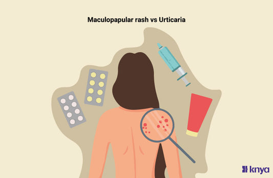 maculopapular rash vs urticaria