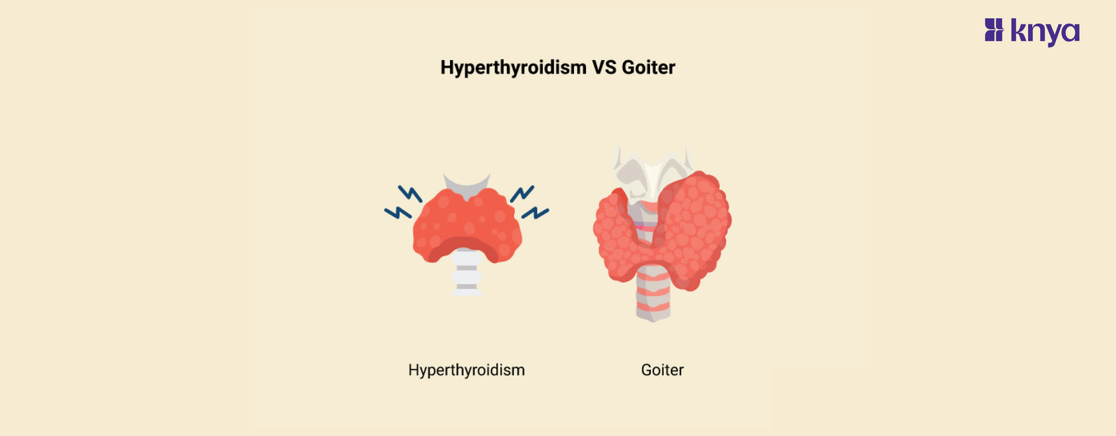 Difference Between Hyperthyroidism and Goiter | Explained! – Knya