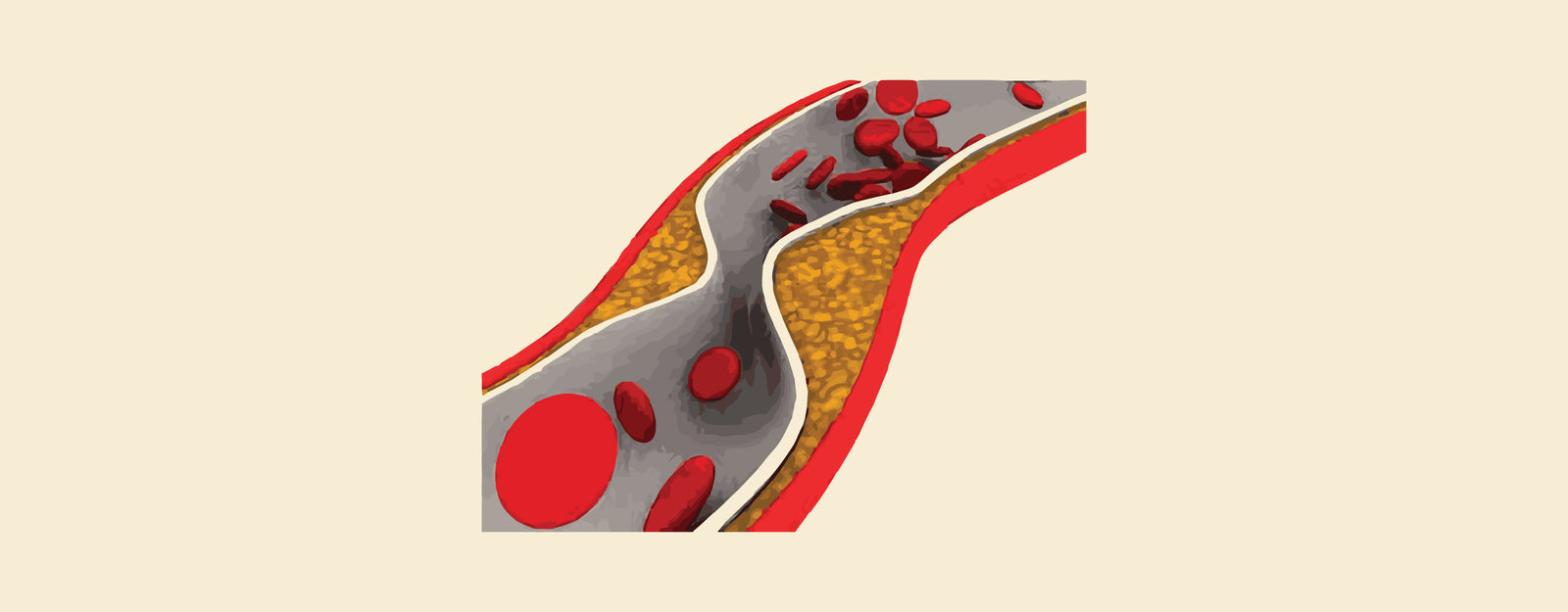 Comparing PCI and CABG: Key Differences in Heart Treatments – Knya