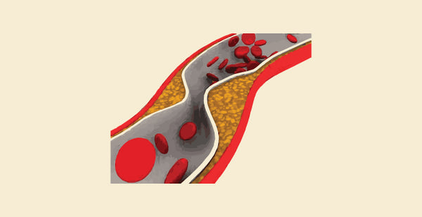 Comparing PCI and CABG: Key Differences in Heart Treatments – Knya